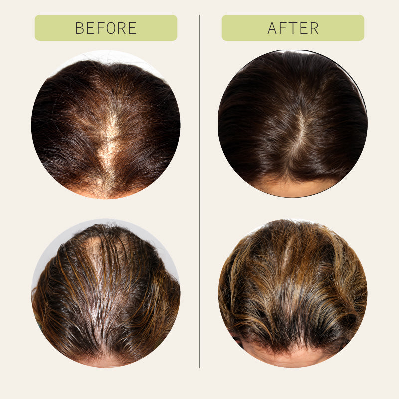Hair Growth Serum