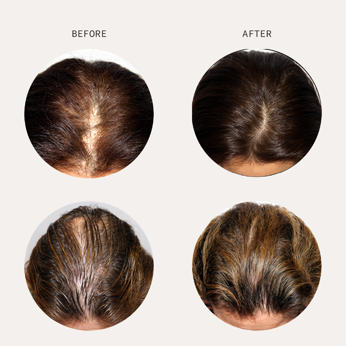 Hair Growth Serum